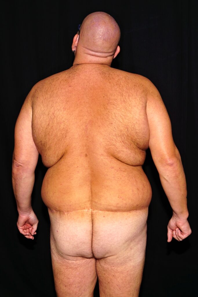 nackt stehend